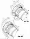 Fig. 06 - Retaining ring assemblies