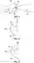 Fig. 03 - Rocket motor with combustion product deflector