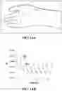 Fig. 10 - Core-shell nanofiber textiles for strain sensing, and methods of their manufacture