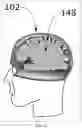 Fig. 12 - Cineradiography-based method and apparatus for testing protective headgear