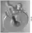 Fig. 17 - Flow cell, read head, and skid attachment