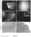 Fig. 03 - Methods and systems for spatially identifying abnormal cells