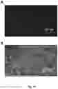 Fig. 11 - Assay with amplification
