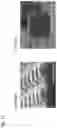 Fig. 15 - Assay with amplification