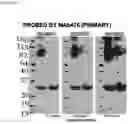 Fig. 08 - Optimizing diagnostics for galactofuranose containing antigens