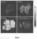 Fig. 09 - Affinity-based detection of ligand-encoded synthetic biomarkers