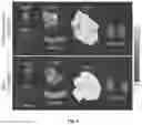 Fig. 10 - Affinity-based detection of ligand-encoded synthetic biomarkers