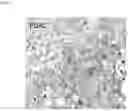Fig. 04 - SENSITIVE DETECTION OF G-PROTEIN COUPLED RECEPTOR-ASSOCIATED SORTING PROTEIN 1 (GASP-1), GASP-1 MICROVESICLES, AND GASP-1 EXOSOMES