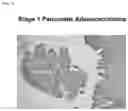 Fig. 05 - SENSITIVE DETECTION OF G-PROTEIN COUPLED RECEPTOR-ASSOCIATED SORTING PROTEIN 1 (GASP-1), GASP-1 MICROVESICLES, AND GASP-1 EXOSOMES