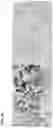 Fig. 04 - Method of identifying treatment responsive non-small cell lung cancer using anaplastic lymphoma kinase (ALK) as a marker