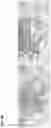 Fig. 09 - Method of identifying treatment responsive non-small cell lung cancer using anaplastic lymphoma kinase (ALK) as a marker