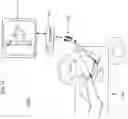 Fig. 12 - Simulated bone or tissue manipulation