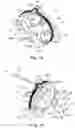Fig. 13 - Developing cartridge having a coupling member and a rotatable lever with a contact portion capable of moving the coupling member