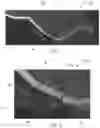 Fig. 02 - AUTOMATED BEAD DETECTION AND DETECTION TRAINING