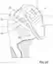 Fig. 06 - Pole handle