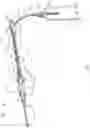 Fig. 09 - Systems and methods for phlebotomy through a peripheral IV catheter