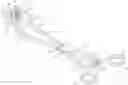 Fig. 01 - Atraumatic tenaculum for facilitation of transcervical procedures