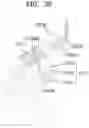 Fig. 46 - Surgical instrument
