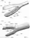 Fig. 06 - LEFT ATRIAL APPENDAGE MANIPULATION AND TRACTION
