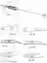 Fig. 02 - Surgical instrument
