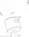 Fig. 06 - Gearbox for atherectomy system