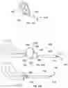 Fig. 13 - Device for applying compression force on the uterine cervix