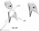 Fig. 14 - Device for applying compression force on the uterine cervix