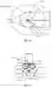 Fig. 08 - System and method for altering rotational alignment of bone sections