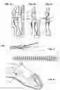 Fig. 02 - Osteosynthesis screw comprising an angular index in relation to the screwdriver
