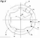 Fig. 04 - Osteosynthesis screw comprising an angular index in relation to the screwdriver