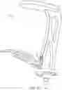 Fig. 07 - Striking assembly and surgical tool assembly