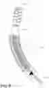 Fig. 10 - Medical ablation devices and methods