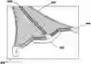 Fig. 01 - Fundus bumper mechanical reference for easier mechanism deployment