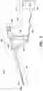 Fig. 02 - Fundus bumper mechanical reference for easier mechanism deployment