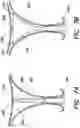 Fig. 08 - Fundus bumper mechanical reference for easier mechanism deployment