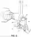 Fig. 07 - Surgical robot for orthopaedic interventions