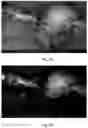 Fig. 09 - Surgical visualization and medical imaging devices and methods using near infrared fluorescent polymers