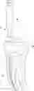 Fig. 01 - DENTAL ROOT CANAL INSTRUMENT