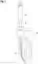 Fig. 02 - DENTAL ROOT CANAL INSTRUMENT