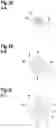 Fig. 04 - DENTAL ROOT CANAL INSTRUMENT