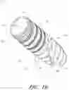 Fig. 03 - DENTAL IMPLANT