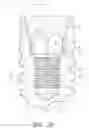 Fig. 05 - DENTAL IMPLANT