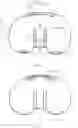 Fig. 03 - Knee prosthesis and knee prosthesis component
