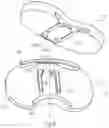 Fig. 07 - Knee prosthesis and knee prosthesis component