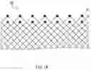 Fig. 02 - STENT AND MEDICAL DEVICE COMPRISING SAME