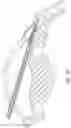 Fig. 07 - INTRAOCULAR SHUNT IMPLANTATION METHODS AND DEVICES