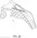 Fig. 45 - INTRAOCULAR SHUNT IMPLANTATION METHODS AND DEVICES