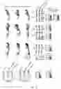 Fig. 11 - TREATMENT OF BONE GROWTH DISORDERS