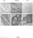 Fig. 41 - TREATMENT OF BONE GROWTH DISORDERS
