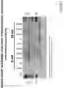 Fig. 72 - Methods for inducing partial apoptosis using caspase polypeptides